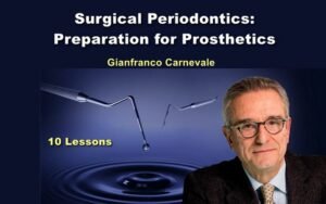 Surgical Periodontics Preparation for Prosthetics Course