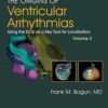 Origins of Ventricular Arrhythmias Volume 2