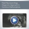 AIUM Fetal Neurosonology Diagnostic Approach