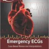 Emergency Ecgs Case Textbook