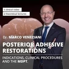 Osteocom Posterior Adhesive Restorations Indications Clinical Course