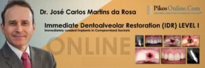 Pikos Institute Idr Immediate Dentoalveolar Restoration Level Course