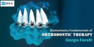 OHI-S Biomechanics Fundamentals of Orthodontic Therapy Course