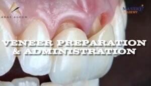 Mastery Academy Veneer Preparation and Administration Course