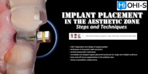 OHI-S Aesthetic Zone Implant Placement Course