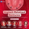 OHI-S Implant Retained Dentures Innovative Approach Full Arch Course