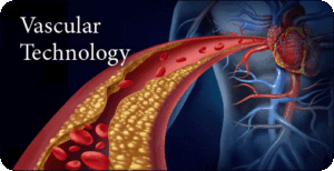 Pegasus Vascular Technology Review 2022