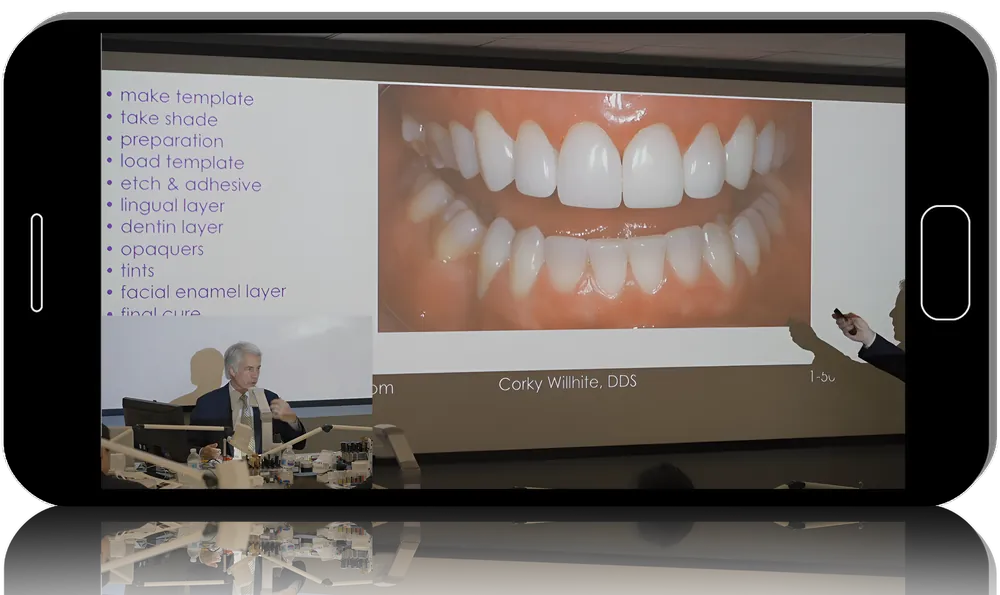 Cosmedent Composite Bonding: “The Ultimate Esthetics”