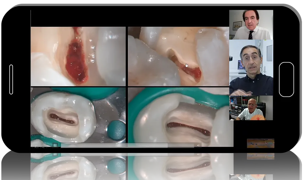 Endodontics in Focus: Expert Perspectives