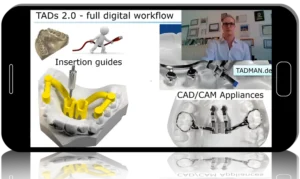Challenging orthodontic cases: the use of skeletal anchorage