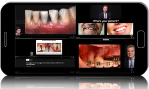 Periodontology: Preservation, Regeneration & Papilla Pack