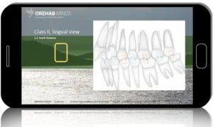 Occlusion in the Functional Concept of Slavicek