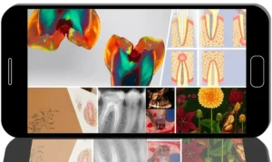 Advanced Clinical Endodontics and Tooth Autotransplantation