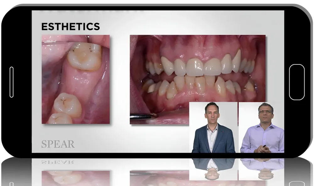 Advanced Implant Treatment Planning and Prosthetic Integration