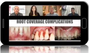 Mucogingival surgery: root coverage protocols 2.0