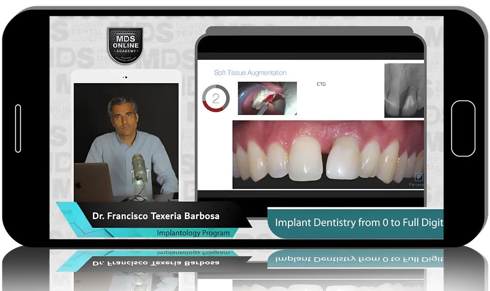 Basic & Advanced Dental Implant Procedures: Everything you need to know about Advanced Implantology Program (Master Dental Society Series)