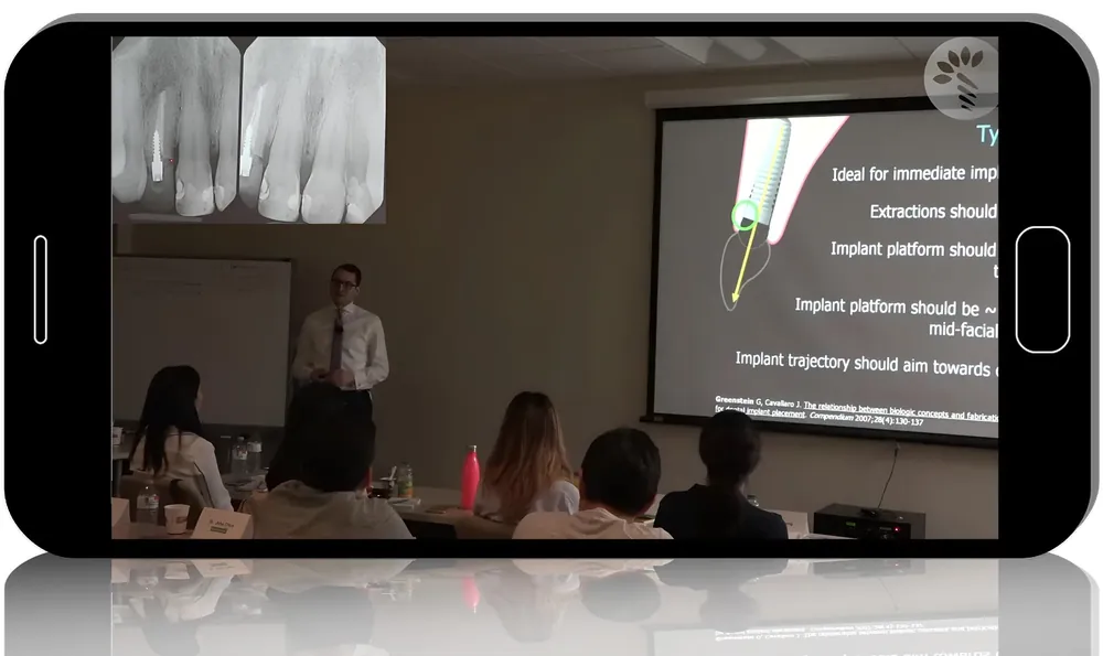 ATRAUMATIC Tooth Extraction: Principles, Concepts, Techniques