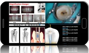 Become Master of Endo with EndoMasters- International EndoMasters Annual Congress 2016