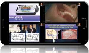 Dental Implants MasterClass: Tipton Training