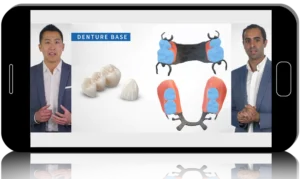 Aligner Mechanics, RPD & Prosthetic Digital Dentistry