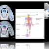 Philosophy of Gnathology Balance of Muscles & Postures