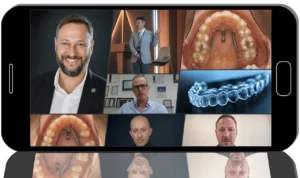 Extreme in orthodontics: treatment of complex cases