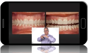 Applying Occlusal Concepts in Practice