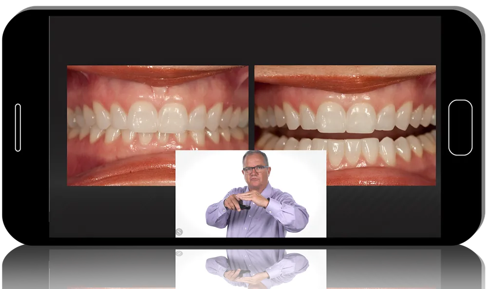 Applying Occlusal Concepts in Practice