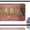 Occlusion: Basics & Beyond