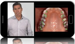 Functional Occlusion: From Records to Refinement