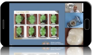 Restorative Dentistry MasterClass: Tipton Training