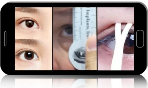 Masterclass in Asian Double Eyelid Design and Crease Formation, Third Iteration