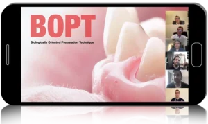 B.O.P.T. concepts: Biologically Oriented Preparation Technique