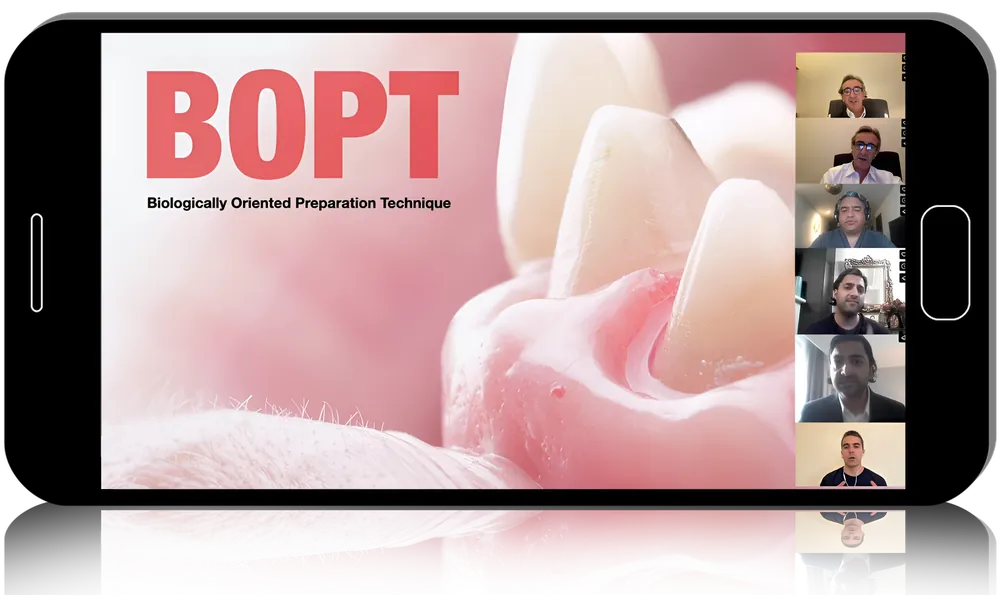 B.O.P.T. concepts: Biologically Oriented Preparation Technique