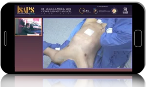 Advanced Techniques in Breast and Body Reshaping