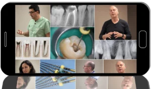 Online Foundations of Predictable Endodontic Success: Putting Theory Into Practice