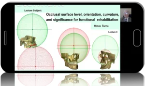 Spherical Occlusion Theory - For Dentists and Dental Technician Team