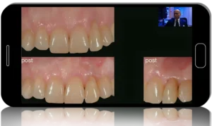 Implant-Perio Evolution 1.0 & 2.0: course of 15 webinars of implantology and periodontology