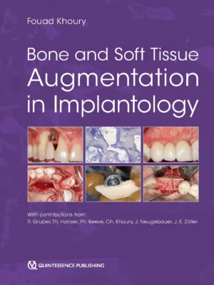 Bone and Soft Tissue Augmentation in Implantology
