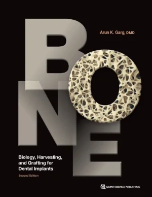 Bone Biology, Harvesting, and Grafting for Dental Implants, 2nd