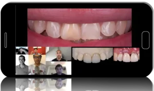 Implant Complications in the Aesthetic Zone