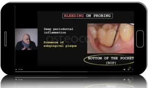 Mucogingival Surgery in Periodontal Therapy. Zucchelli Masterclass 2024.