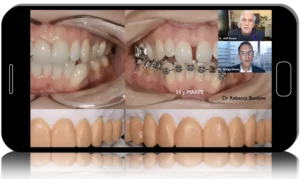 Treating the Worn Dentition
