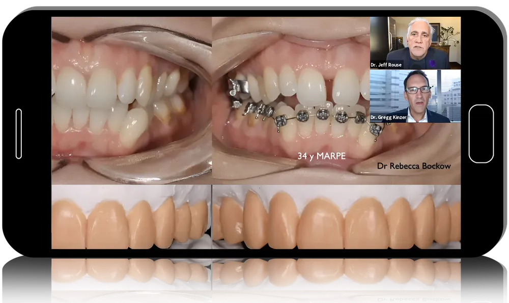Treating the Worn Dentition