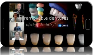 Removable dentures