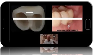 Perio-Restorative Protocols: Team-Based Approach