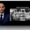 Dental Implant Complications