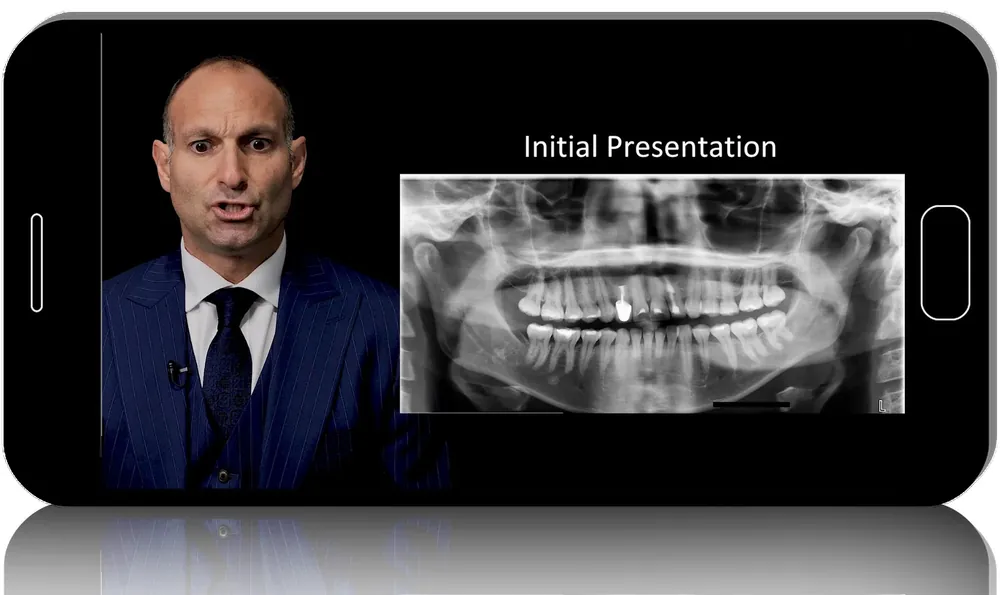 Dental Implant Complications