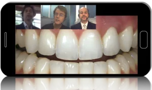 gIDE - A to Z in Cosmetic Dentistry