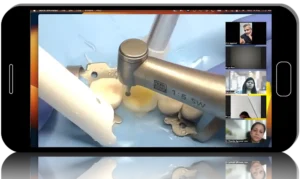 Posterior Partial Bonded Restorations and Adhesion in Dentistry